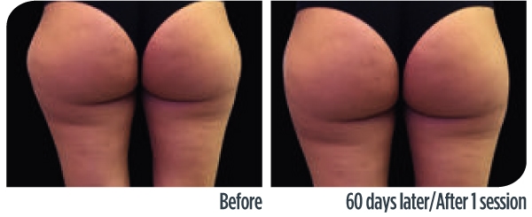 TechnicalLeaflet_RenovaOmnia_2022-1