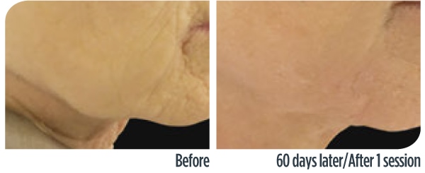 TechnicalLeaflet_RenovaOmnia_2022-2